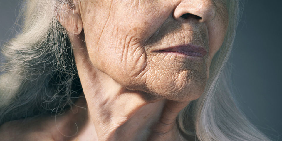 Ageism